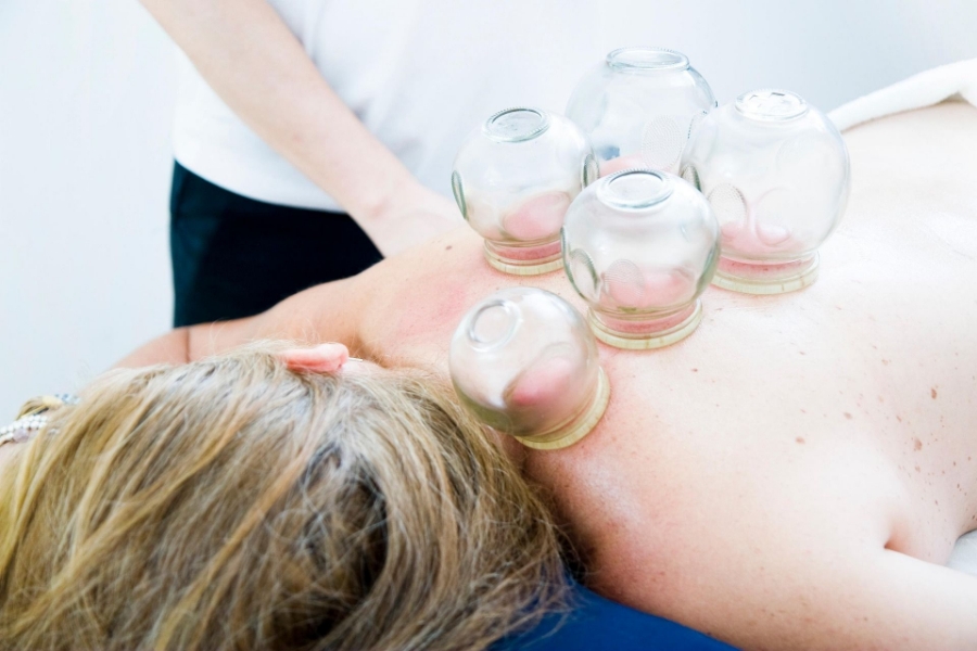 Myofascial Dry Cupping
